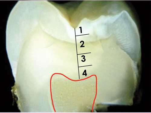 Level of dental cavity